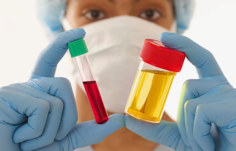 Почему стоит сдавать анализы без симптомов: профилактика XXI века